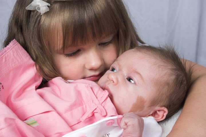 tanda lahir pada bayi